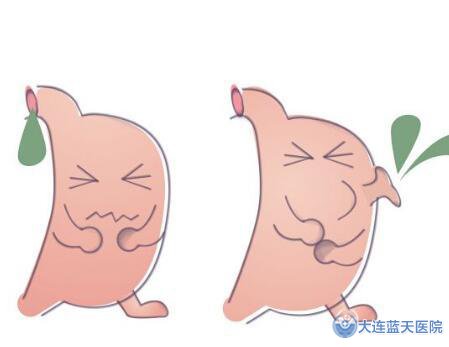 浅表性胃炎的发病原因