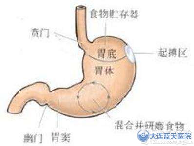 糜烂性胃炎会不会传染