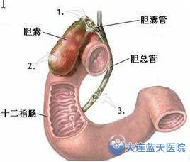 结肠炎的药物治疗